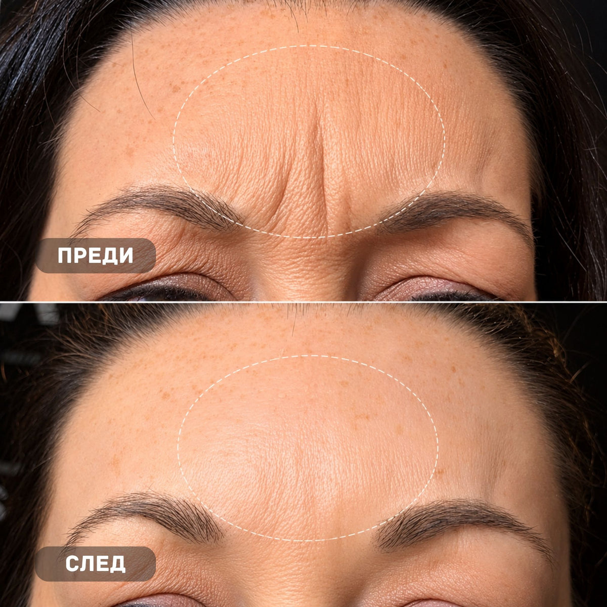 True Skin Стягащ Крем с NAD+ и Пептиди