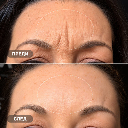 True Skin Стягащ Крем с NAD+ и Пептиди