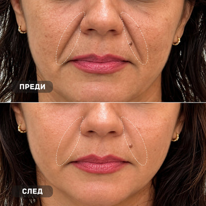 True Skin Стягащ Крем с NAD+ и Пептиди